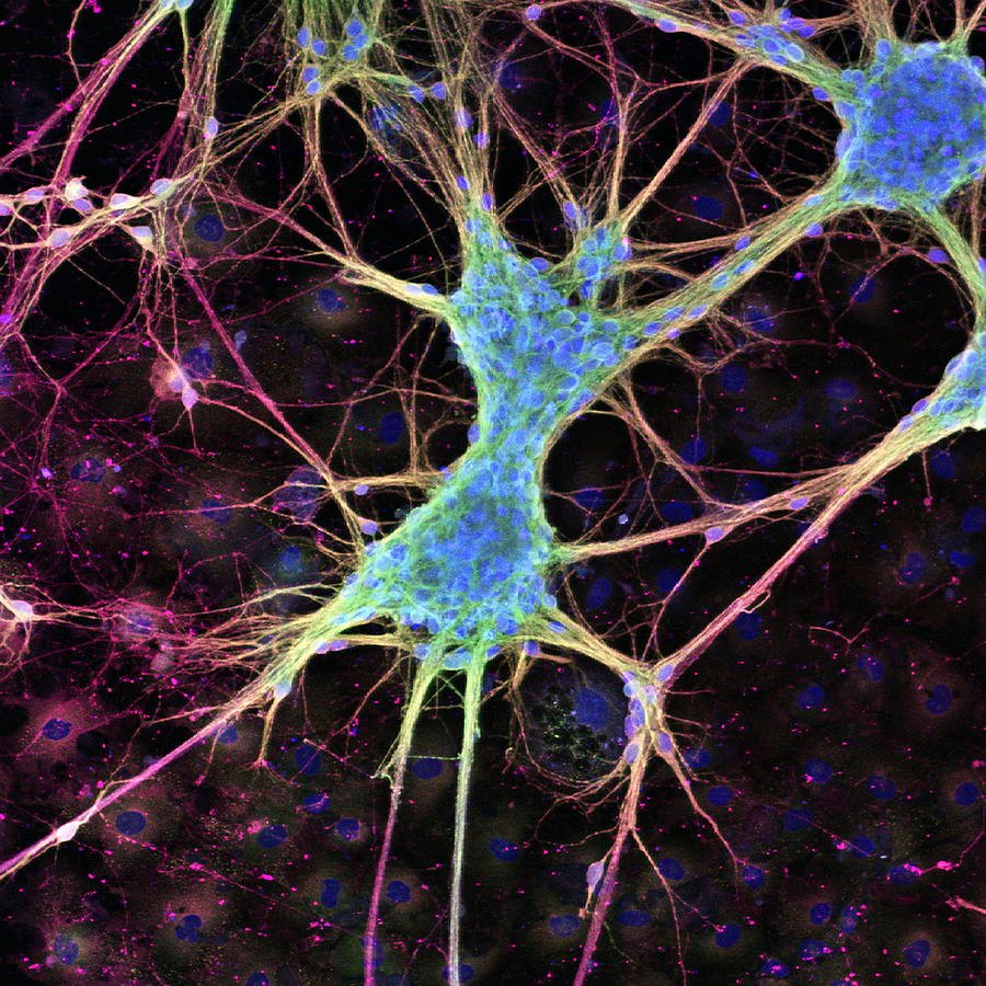 Microscopic nerve-cell image used to illustrate the nervous system